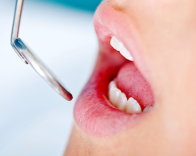 Dental Insterment Near Mouth